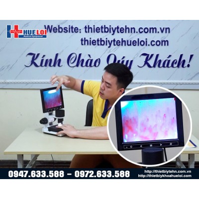 Kính Hiển Vi Soi Mạch Máu